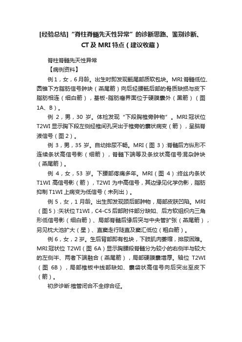 [经验总结]“脊柱脊髓先天性异常”的诊断思路、鉴别诊断、CT及MRI特点（建议收藏）