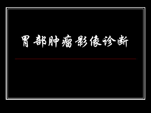 (精品)放射课件：胃部肿瘤影像诊断