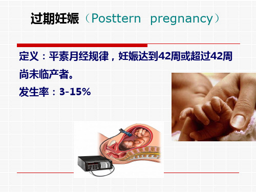 过期妊娠-精品医学课件