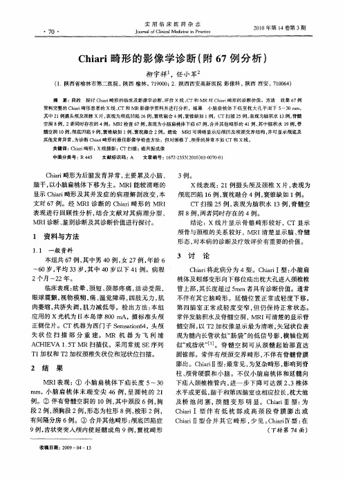 Chiari畸形的影像学诊断(附67例分析)