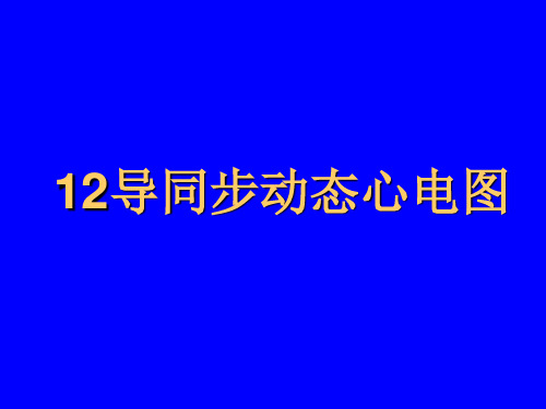 12导动态心电图