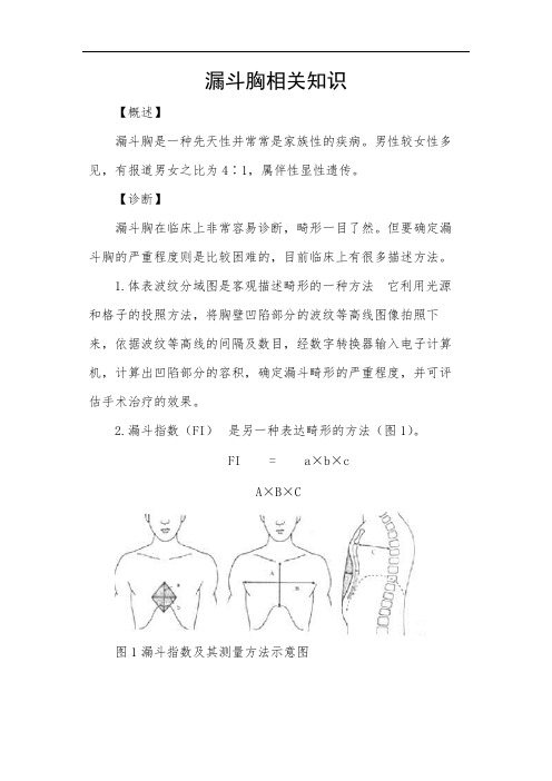 漏斗胸相关知识