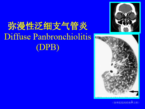 弥漫性泛细支气管炎