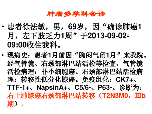 病例：肺癌