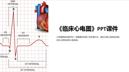 《临床心电图》课件