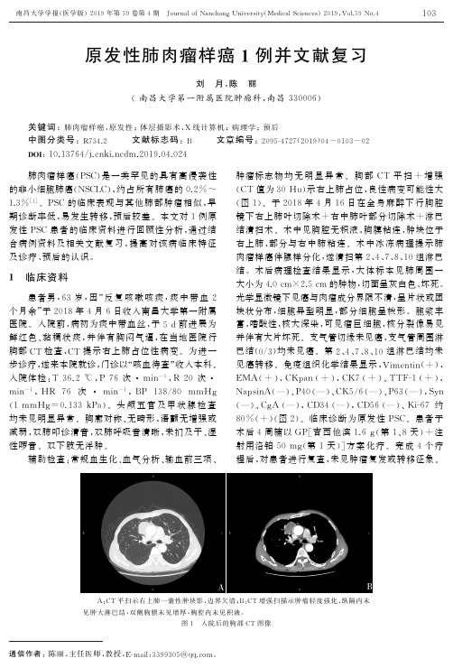 原发性肺肉瘤样癌1例并文献复习