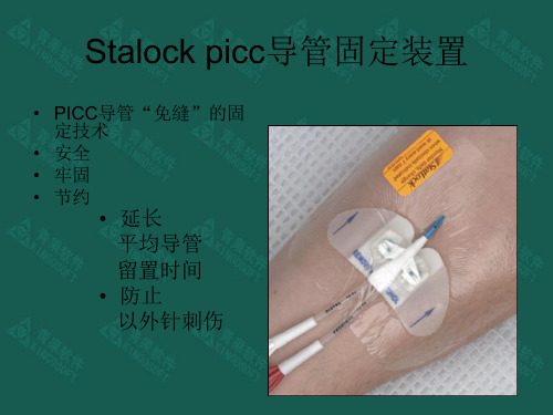 Stalock picc导管固定装置(思乐扣)