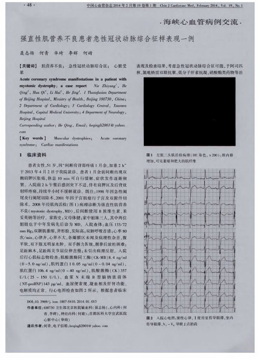 强直性肌营养不良患者急性冠状动脉综合征样表现一例