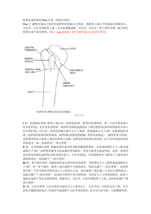 第七课：肩关节neer分型