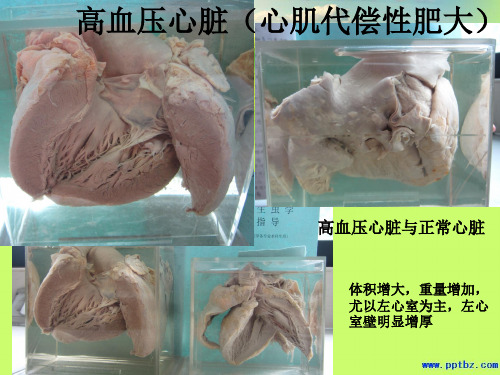 病理学大体标本完整版本