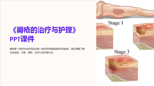 《褥疮的治疗与护理》课件