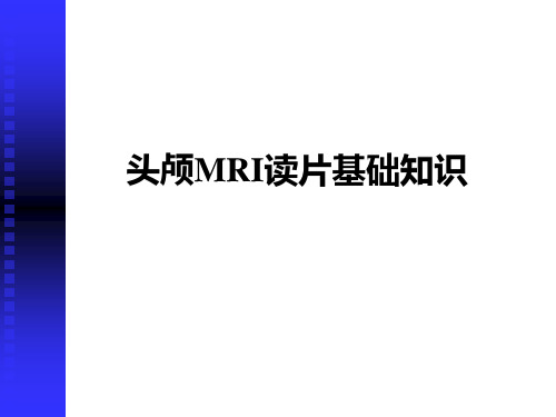 头颅MRI基础知识1-硬件结构