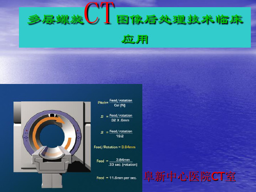 CT图像后处理技术