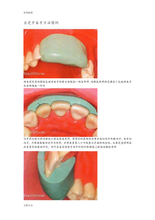 全瓷牙备牙方法图例