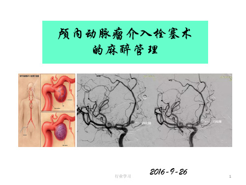 颅内动脉瘤介入栓塞术的麻醉管理[荟萃精制]