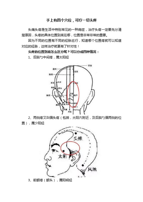 手上有四个穴位，可疗一切头疼