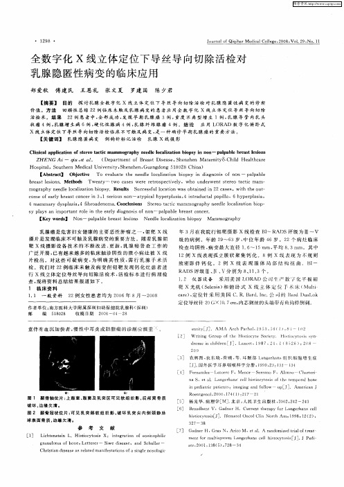 全数字化X线立体定位下导丝导向切除活检对乳腺隐匿性病变的临床应用