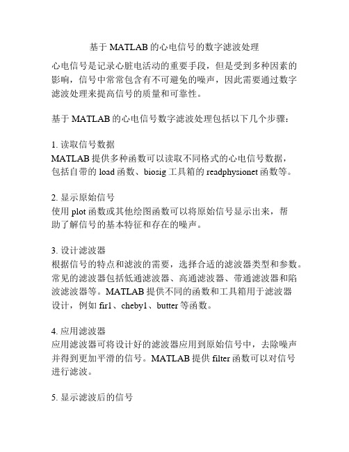 基于MATLAB的心电信号的数字滤波处理