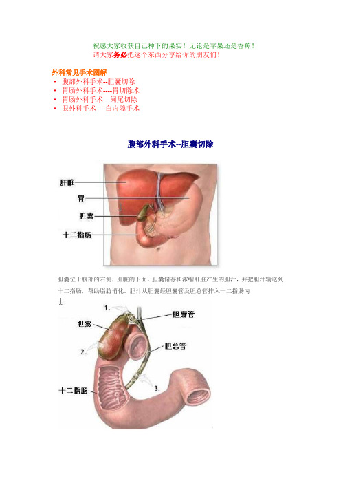 外科常见手术图解