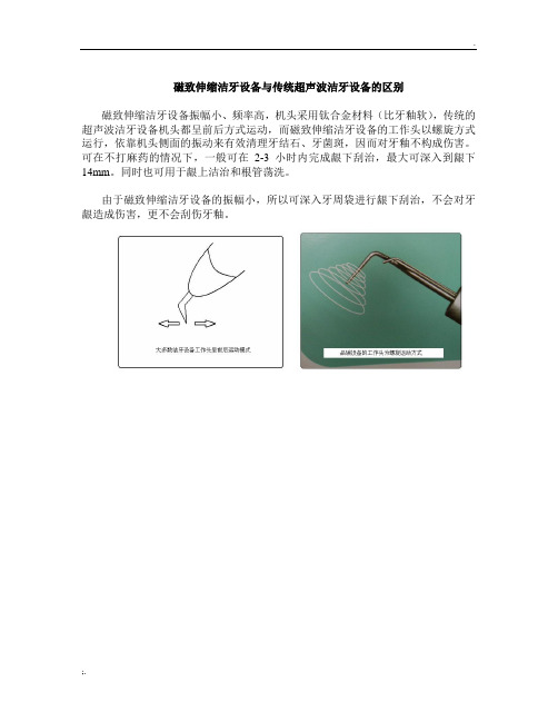 磁致伸缩洁牙设备与传统超声波洁牙设备的区别