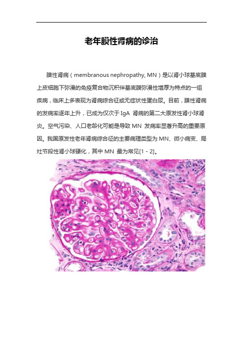 老年膜性肾病的诊治