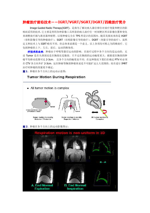 肿瘤放疗前沿技术--IGRT
