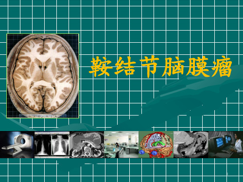 鞍结节脑膜瘤最新影像诊断ppt课件