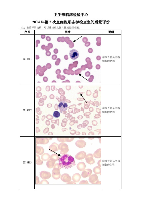 2014年第3次血细胞形态室间质评答案及解析