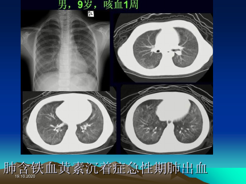 胸部少见疾病影像诊断课件文档资料