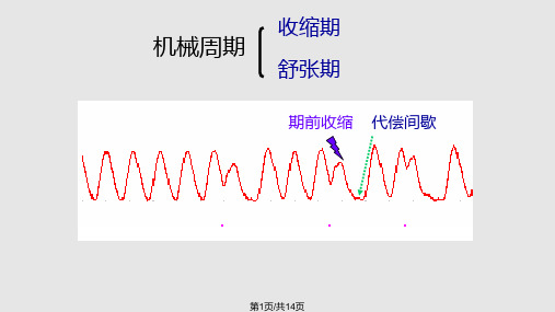 机能实验期前收缩与代偿间歇