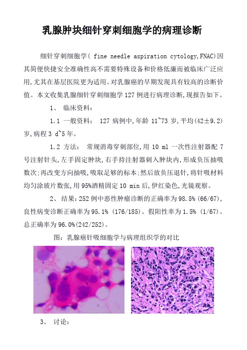 乳腺肿块细针穿刺细胞学的病理诊断