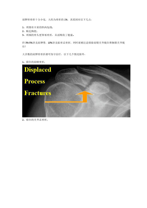 肩胛骨骨折的内固定手术技巧