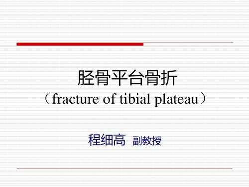 胫骨平台骨折fractureoftibialplateau