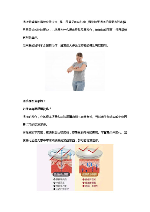 皮炎湿疹反复发作怎么办？