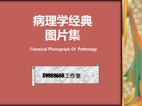 病理学经典图片集(胰腺)