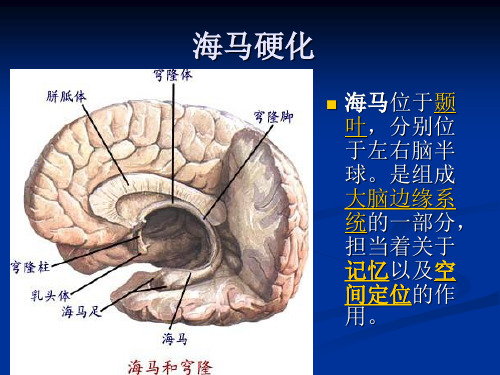 海马硬化