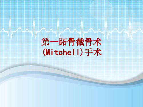 手术讲解模板：第一跖骨截骨术(Mitchell)手术