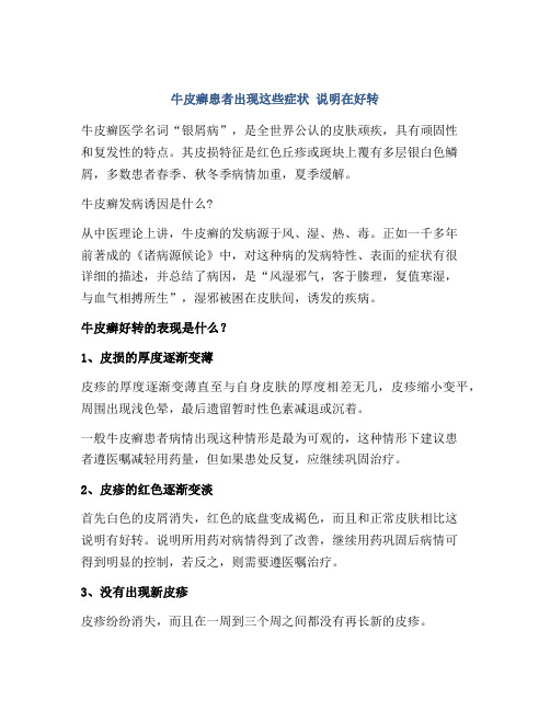 牛皮癣患者出现这些症状 说明在好转