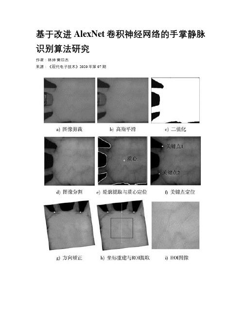 基于改进AlexNet卷积神经网络的手掌静脉识别算法研究