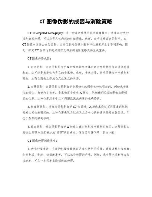 CT图像伪影的成因与消除策略