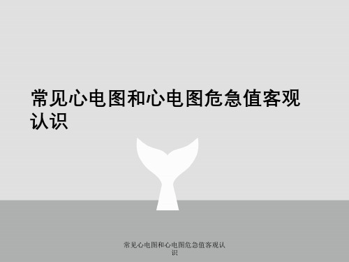 常见心电图与心电图危急值客观认识