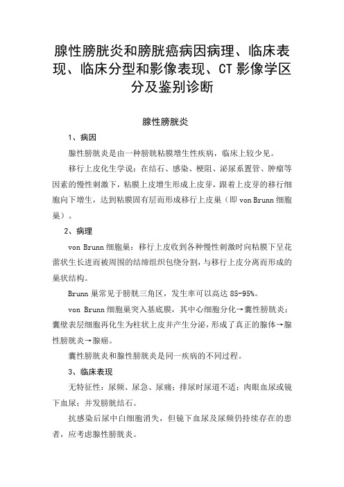 腺性膀胱炎和膀胱癌病因病理、临床表现、临床分型和CT影像学区分表现及鉴别诊断