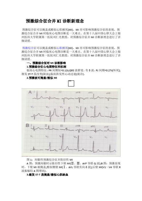 预激综合征合并MI诊断新理念