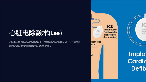 心脏电除颤术(Lee)