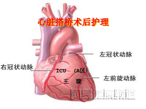 (精品)心脏搭桥PPT演示课件