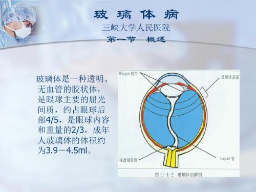 玻璃体病课件