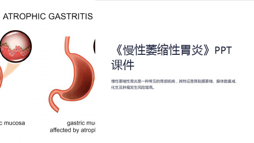 《慢性萎缩性胃炎》课件