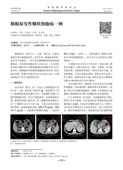 胰腺原发性鳞状细胞癌一例