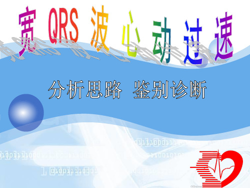 宽QRS波心动过速的分析思路和鉴别诊断
