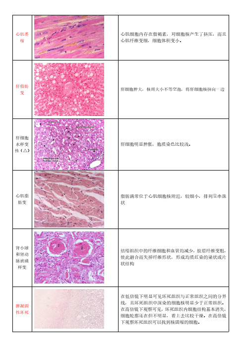 病理学实验考复习资料切片描述-pl学姐